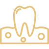 Boala parodontala